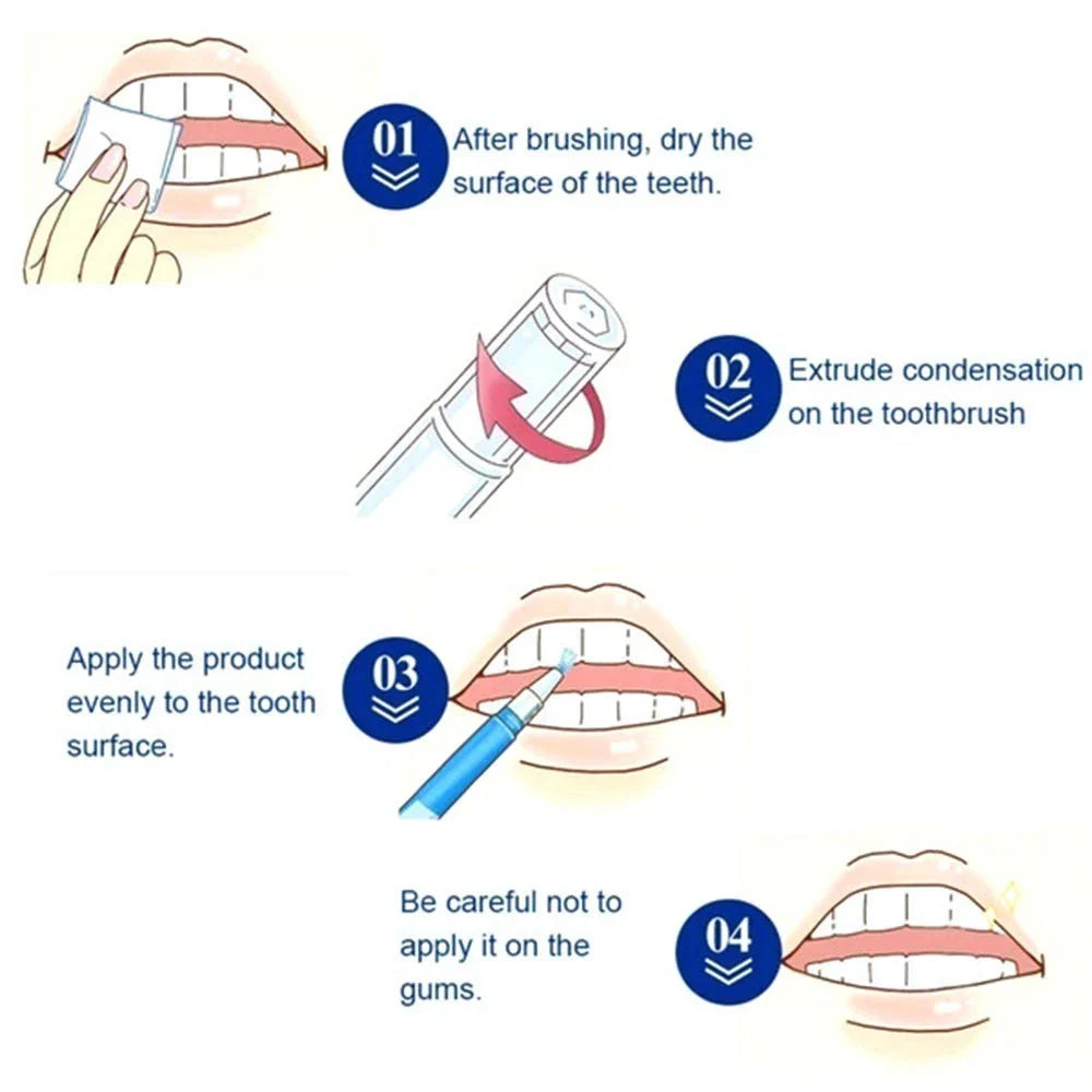 SmileBright™ Teeth Whitening Pen