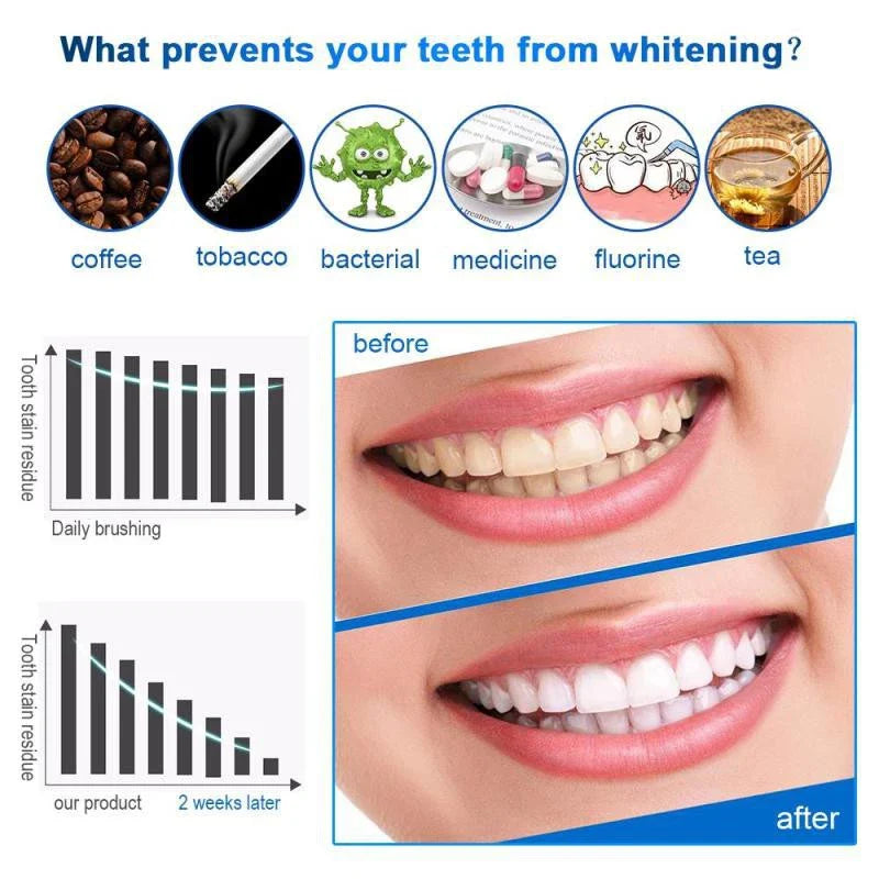 SmileBright™ Teeth Whitening Pen