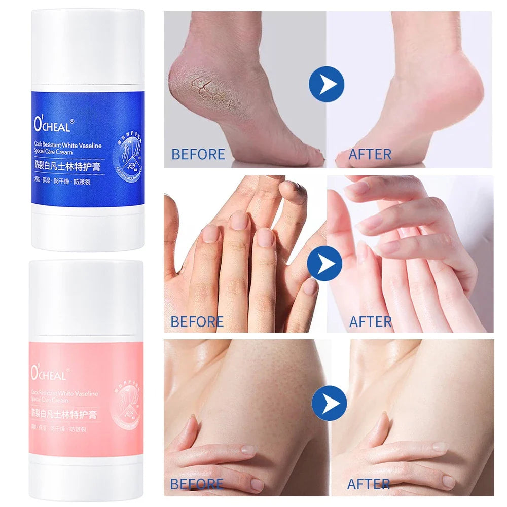 HeelGuard™ Repair and Protect
