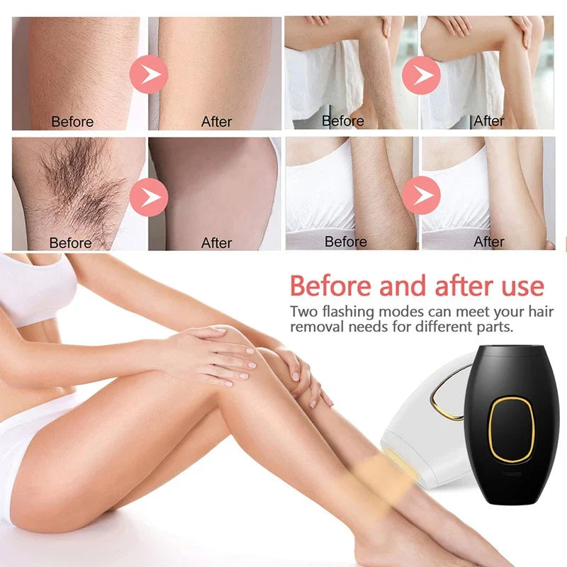 SmoothSkin™ Laser Hair Remover